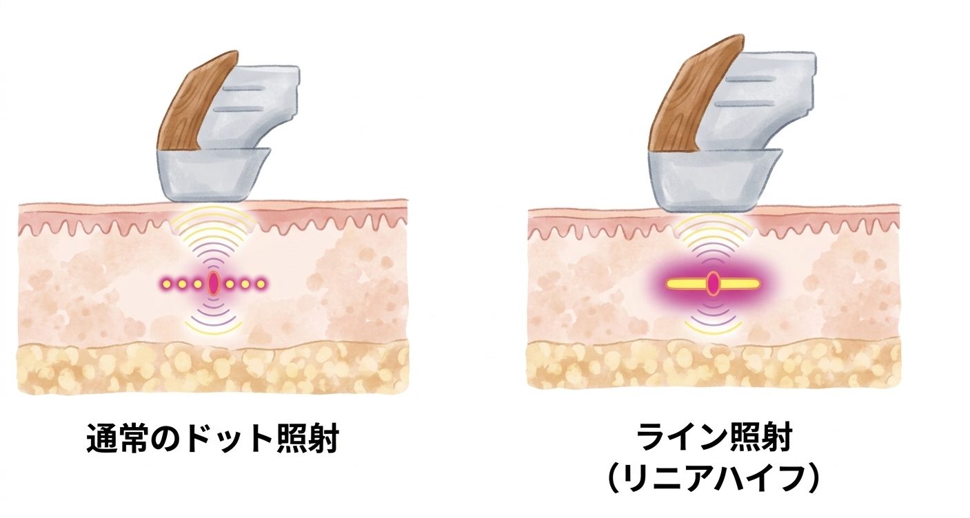 リニアハイフ