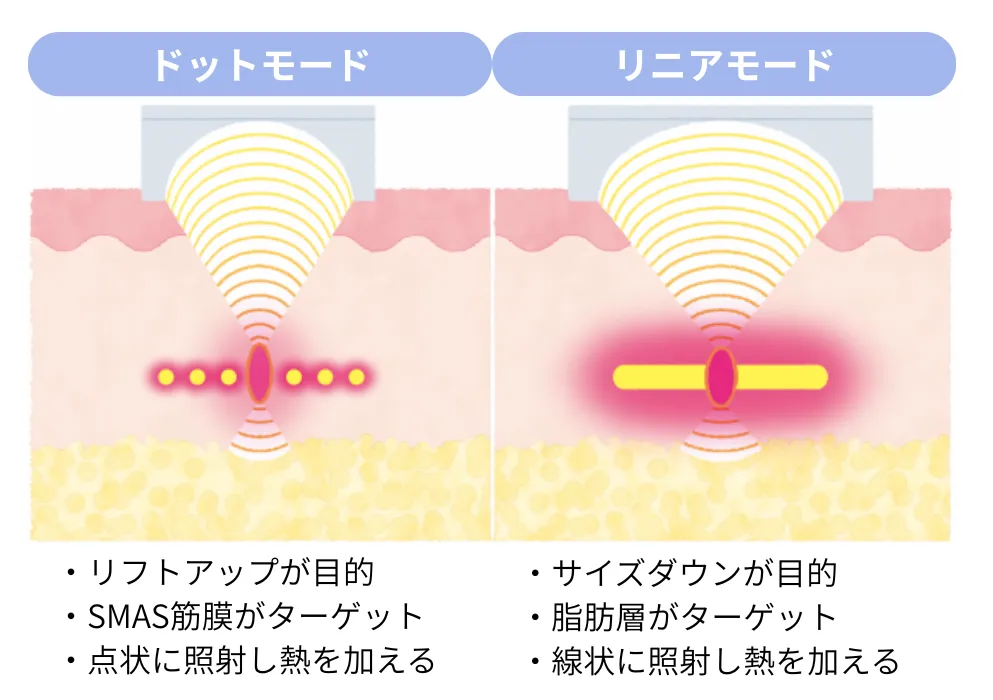 リニアハイフとドット状とリニア上の違いの説明