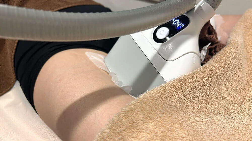 脂肪冷却施術のイメージ