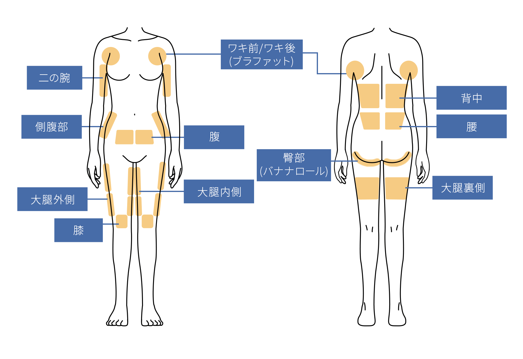 脂肪冷却の適応部位