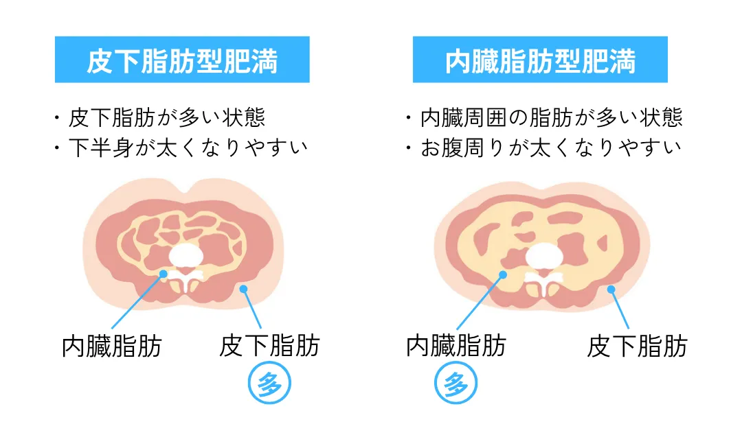 内臓脂肪型肥満と皮下脂肪型肥満の違いを説明した画像
