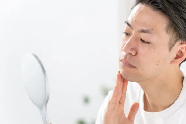 泥棒ヒゲとは？ヒゲ脱毛後に濃く見える原因と対策・硬毛化との違いを解説