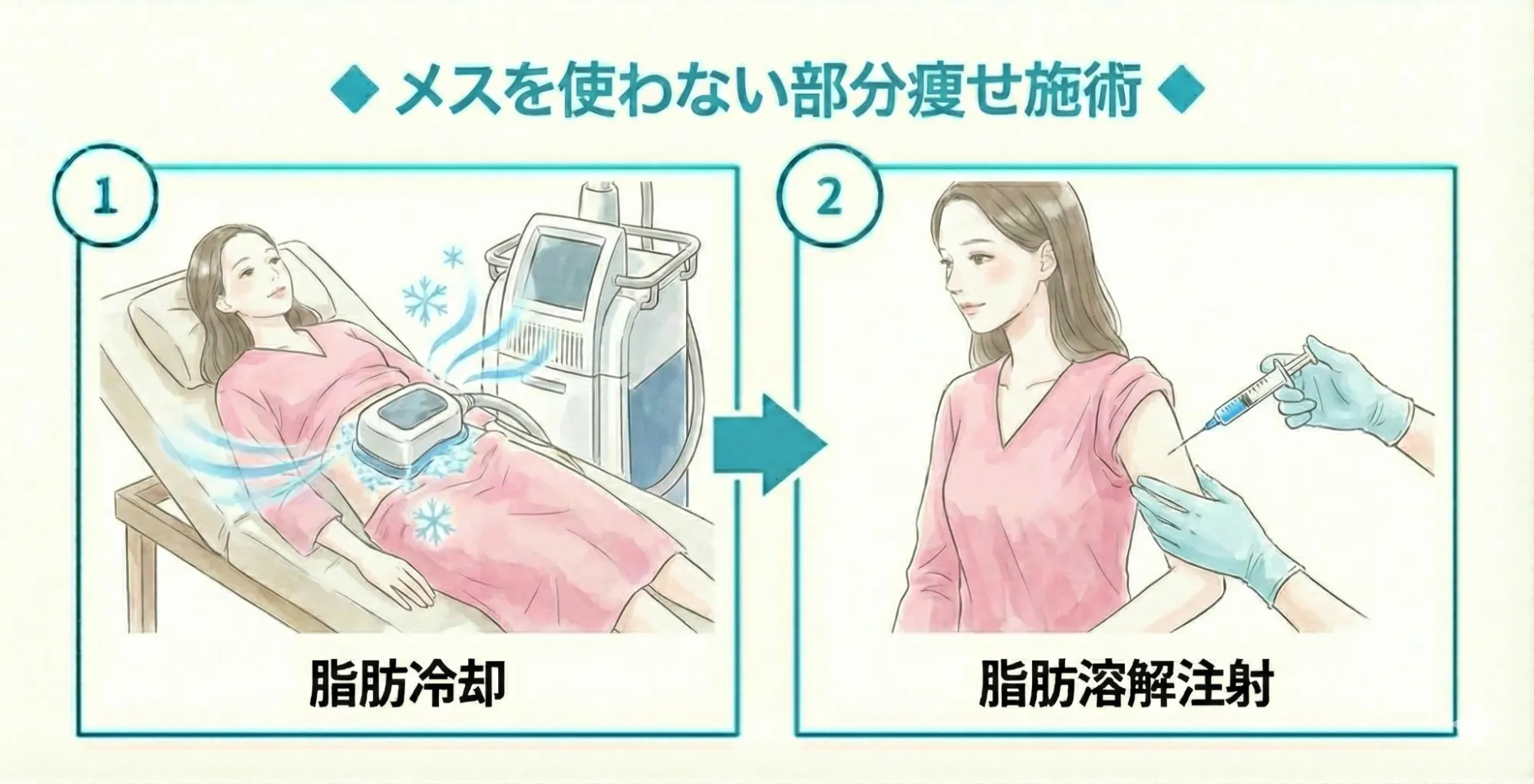 メスを使わない部分痩せ施術