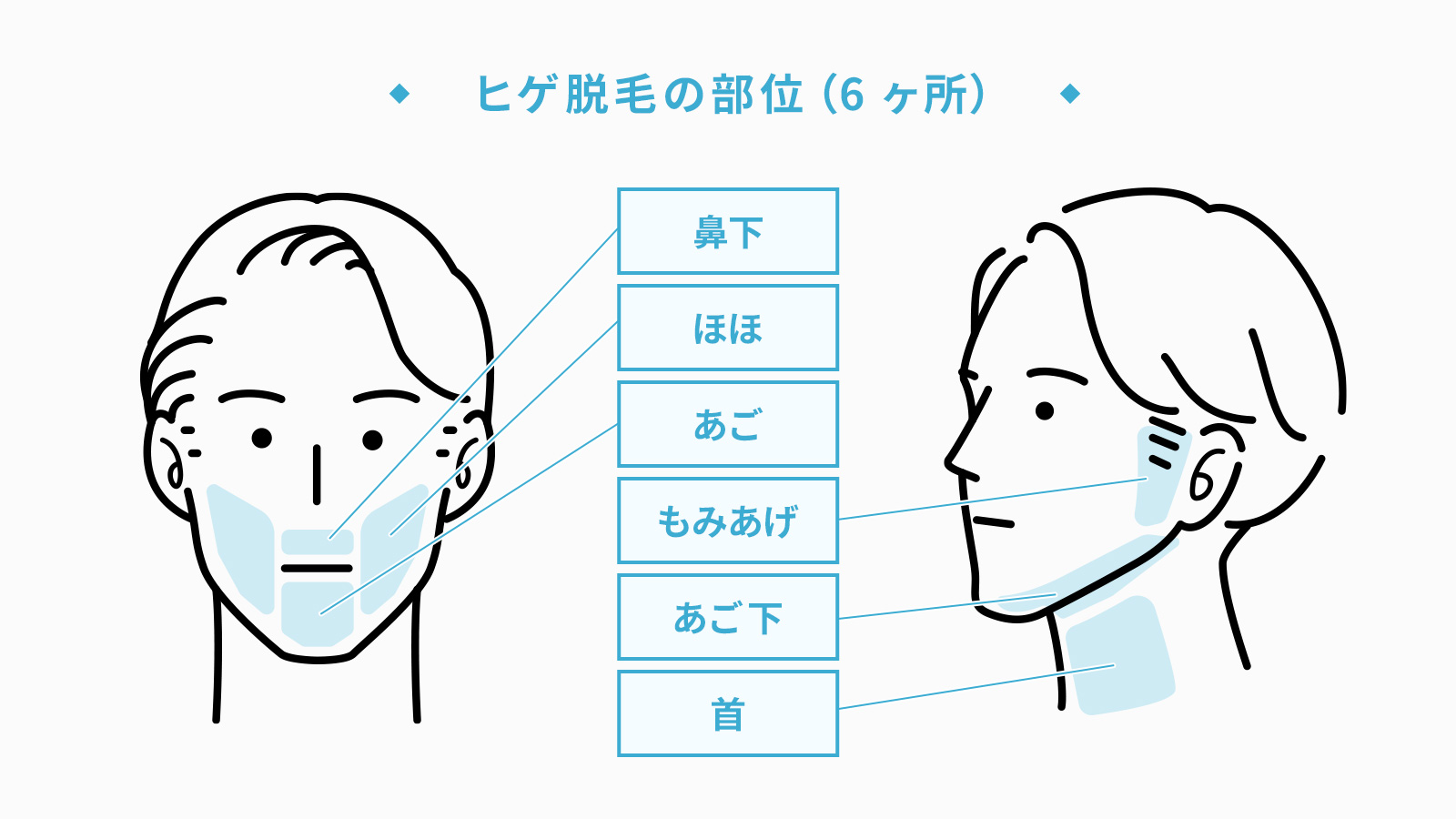 ヒゲ脱毛の範囲の例