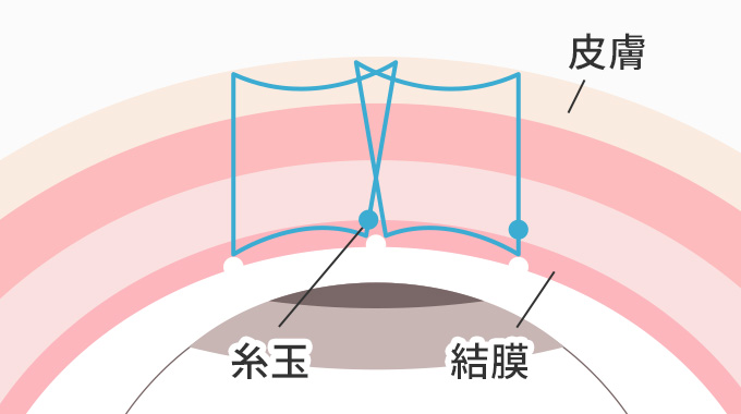 裏留めを説明した画像