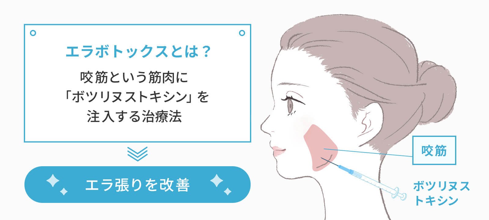 エラボトックスとは?を表した独自で作成した画像