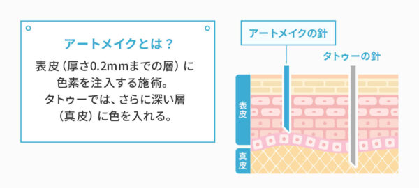 アートメイクとは、肌の浅い層（肌表面から0.2mm程度）に色素を入れる医療行為。というのを図版で表しています。