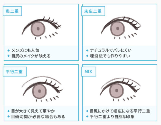 二重整形のデザインを4つ紹介している画像を作成しました。奥二重、末広二重、並行二重、MIXの4つです。奥二重はメンズに人気で目尻のメイクが映えます。末広二重は、ナチュラルでバレずらく、埋没法でも作りやすいです。並行二重は、目が大きく見えて華やかな一方、切開する必要がある場合もあります。MIXは、目尻にかけて幅広になる並行二重で、並行二重よりも自然な二重です。