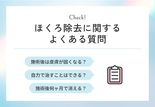 ほくろ除去に関するよくある質問