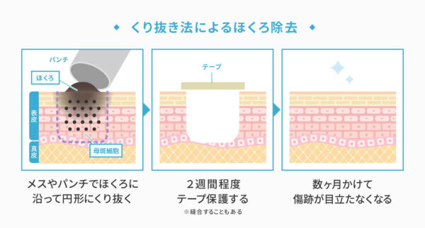 くり抜き法を説明した図版