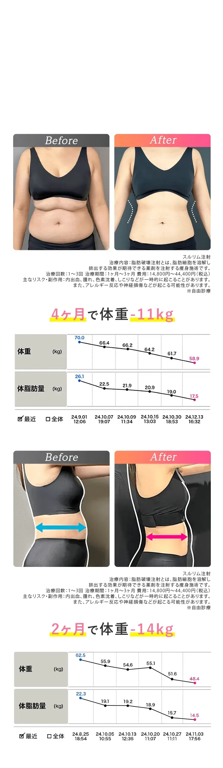 症例写真の紹介