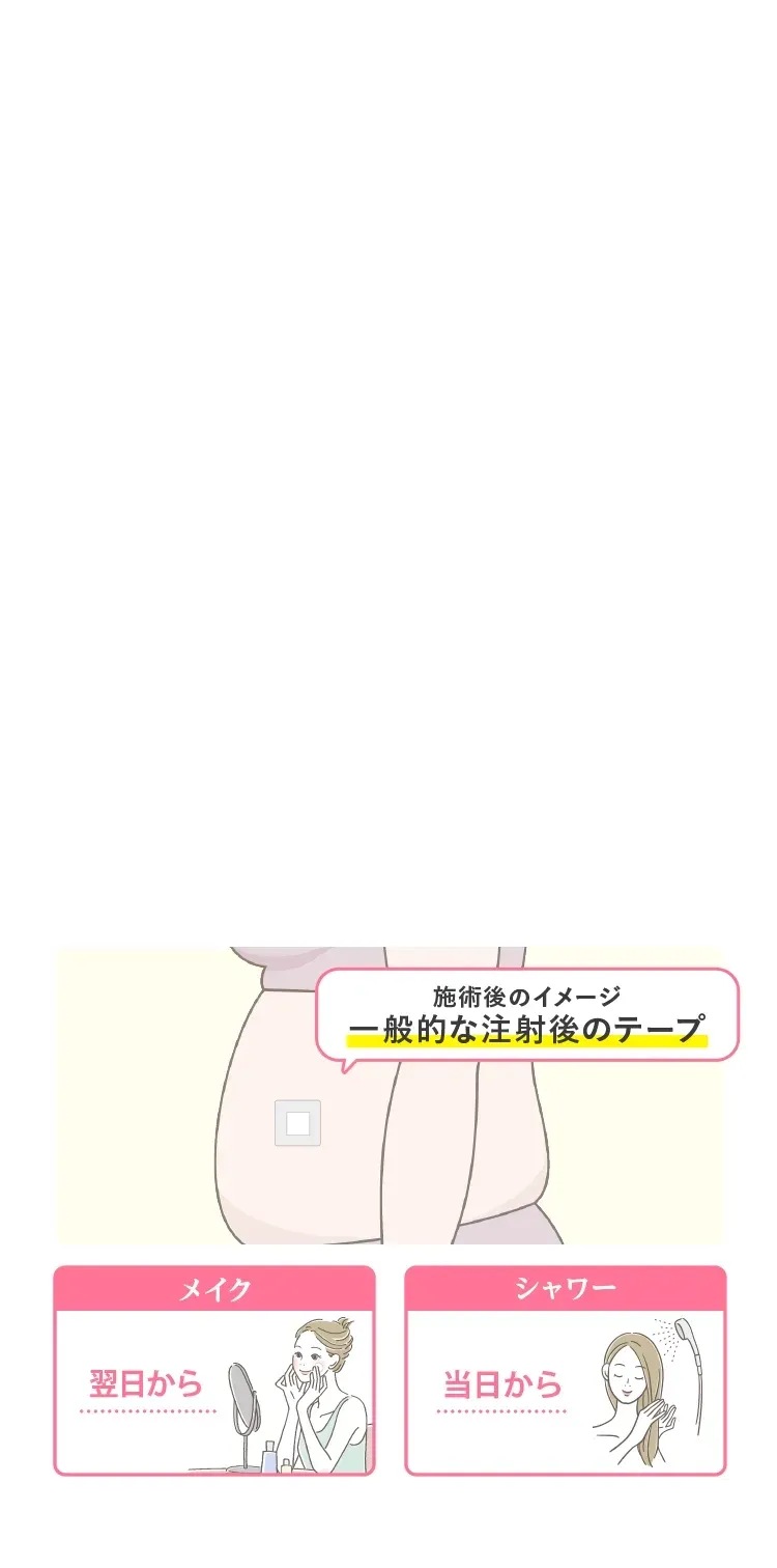 施術時間はたったの約15分、ダウンタイムが短い、極細針&麻酔成分配合で痛みを最小限に