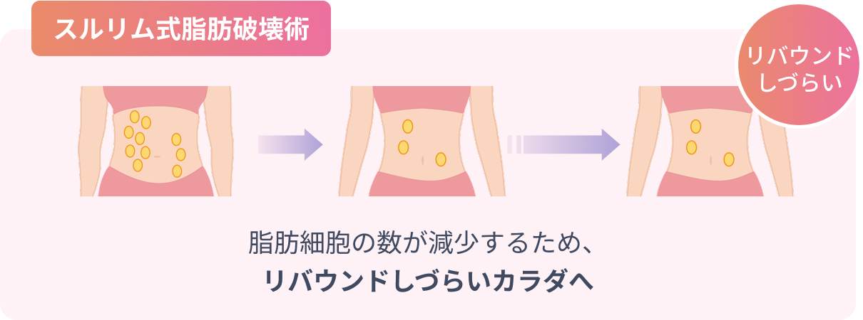 スルリム式脂肪破壊術の脂肪細胞の変化
