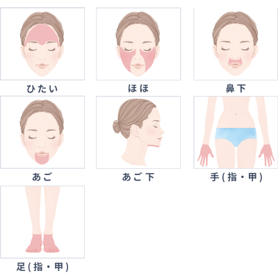 Sパーツの都度払い