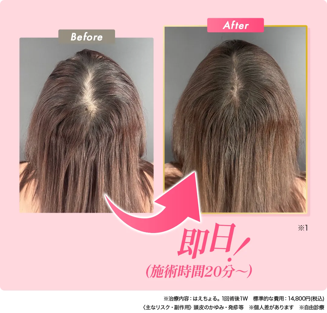 BeforeAfter