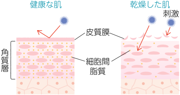 健康な肌と乾燥した肌の違いのイラスト