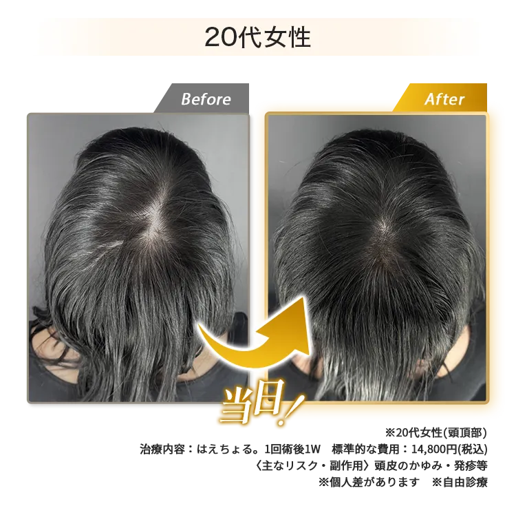 女性20代