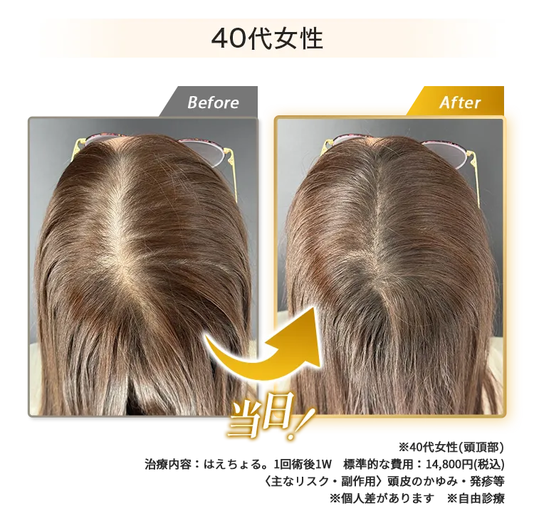 女性40代