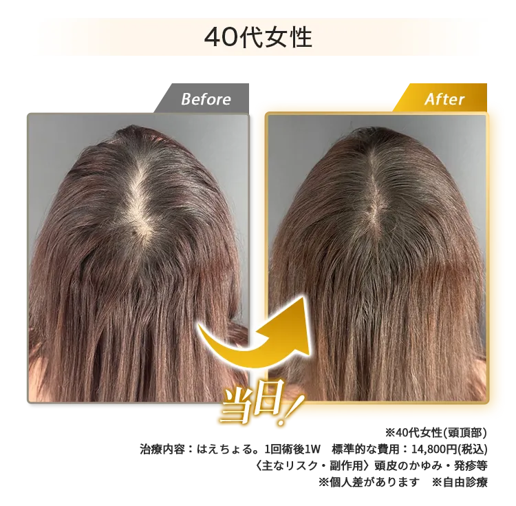 女性40代