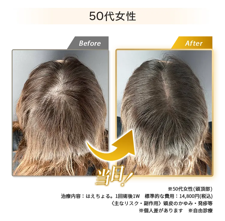 女性50代