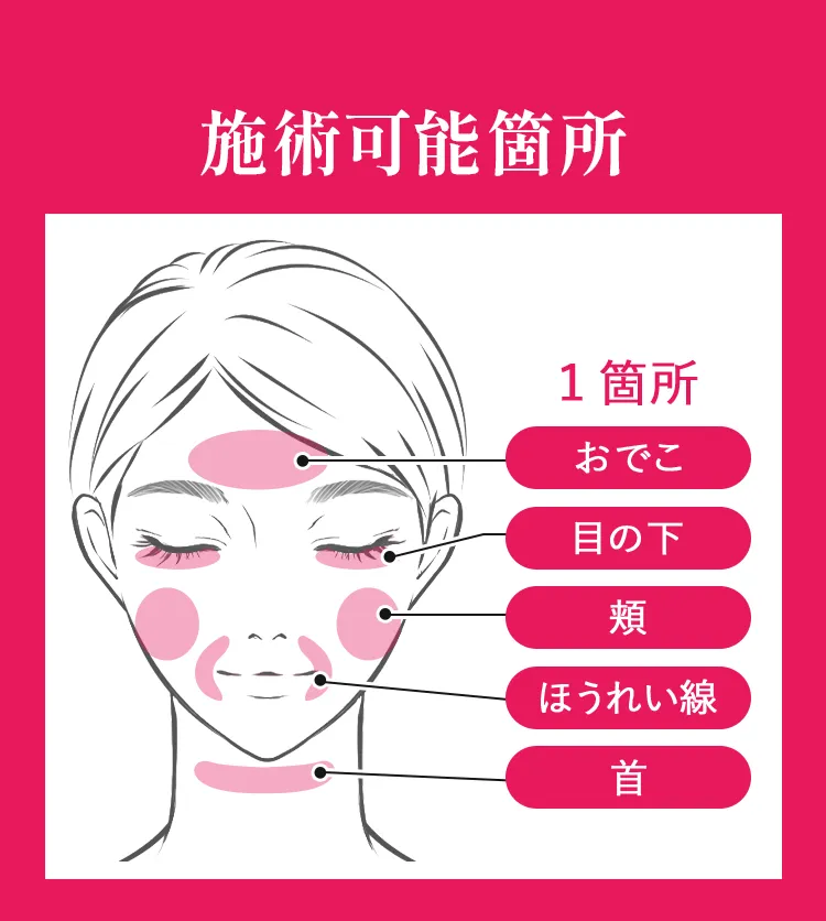 施術可能箇所