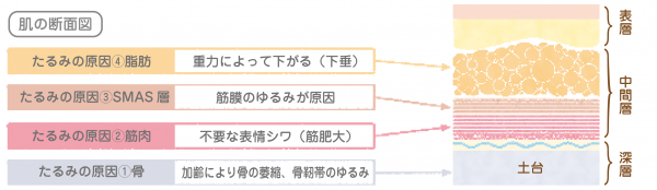 肌の断面図