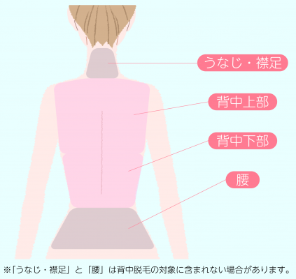 「うなじ（襟足）」は背中脱毛の照射範囲に含まれないことが多い