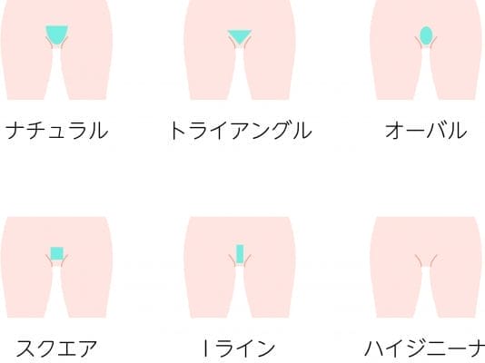 Vライン脱毛のデザイン